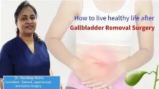 How To Live Healthy Life After Gallbladder Removal | Dr. Hardeep Bains #gallstone_laser_surgery