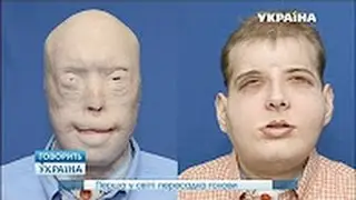 🔥 Первая в мире ПЕРЕСАДКА ГОЛОВЫ ¦ Говорит Украина