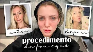 FIZ O PROCEDIMENTO ESTÉTICO DE FOX EYES!