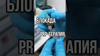 🔍БЛОКАДА ИЛИ PRP-ТЕРАПИЯ? 
