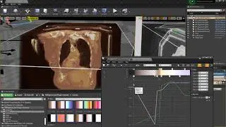 TBRaymarchPlugin - UE4 Medical Data Volumetric Rendering (Raymarching) - Part 1