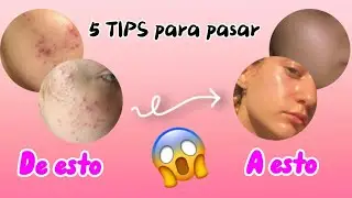 5 TIPS para tener una piel RADIANTE 💗 | Moonie