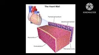 Myocardial Infaction In Bengali
