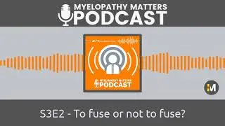 S3E2 - To fuse or not to fuse?