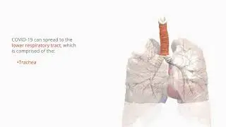 Coronavirus disease 2019