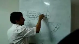 Efecto de los elasticos clase II