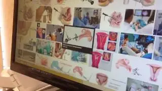 Полипы женских половых органов простыми словами