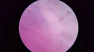 Focusing in on a Purple Onion