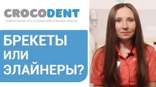 🤔  Элайнеры или брекеты - отличия, правила ухода, что лучше. Элайнеры или брекеты что лучше. 12+