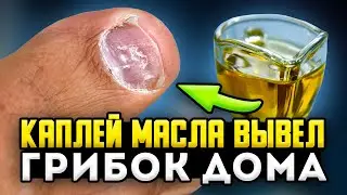 Дерматолог: капнул и вытираешь вместе с ГРИБКОМ, а ЕСЛИ масло смешать с
