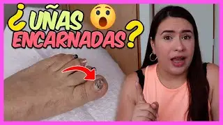 ¿Cómo SACAR una UÑA ENCARNADA? HÁZLO como PROFESIONAL ✅ - Curso De Uñas #012