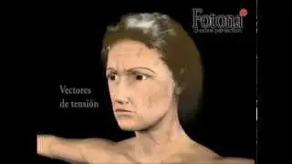 Tensado Facial con Modo Smooth