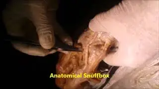 Forearm Flexor Dissection Composite Video-ClinicoSurgical Correlations  - Sanjoy Sanyal