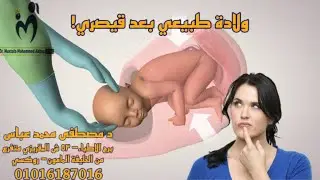 طبيعي بعد قيصرية