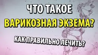 Что такое варикозная экзема. Как лечить