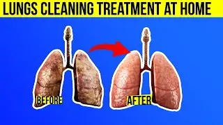 Lungs Cleaning Treatment For Smokers At Home