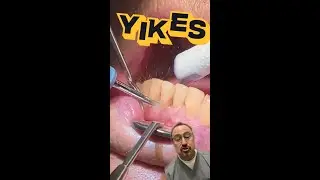 Best Dental Tips For Healthy White Teeth 2022 | Product Reviews, Reactions, and Memes 2022 (Part 1)