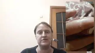 Ладонно-подошвенный синдром.  Как я с ним сражалась .