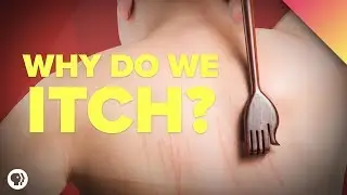 Why Do We Itch?
