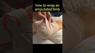 How to Wrap a Stump 