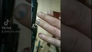 УШИБ  НОГТЯ 100% ИЗБАВЛЕНИЕ ОТ БОЛИ.