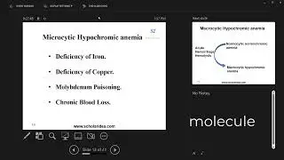 Iron deficiency anemia (أنيميا نقص الحديد)