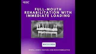 [Master Course - PROSTHODONTICS] Full-mouth rehabilitation with immediate loading