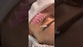 #мезонити