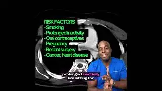 Case #3: Chest Pain