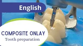 Composite onlay - pat 1: tooth preparation.
