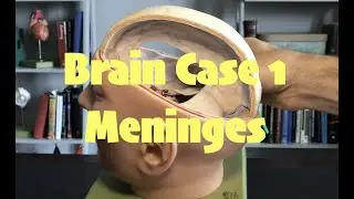 Brain Case 1: Cranial Meninges