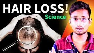 The Truth About Hair Loss in India: Myths and Facts | How To Stop Hair Fall | Mr Suvendu