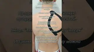 Сколиотическая осанка
