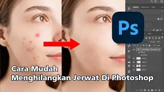 CARA MUDAH MENGHILANGKAN JERAWAT DI PHOTOSHOP