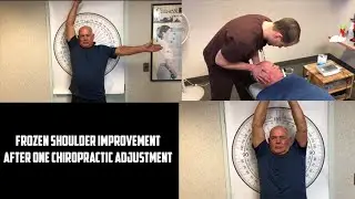 Frozen Shoulder Improvement After One Chiropractic Adjustment