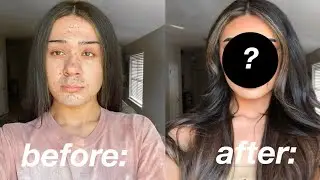 I GOT PLASTIC SURGERY *not clickbait*