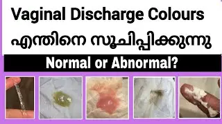 Vaginal Discharge Colours & Reasons || Malayalam