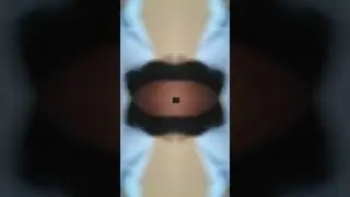 eye