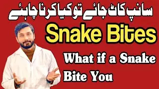 What if a Snake Bite you | snake bite First Aid|سانپ کے زہر کا علاج