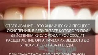 7 мифов о стоматологии, про которые пора забыть