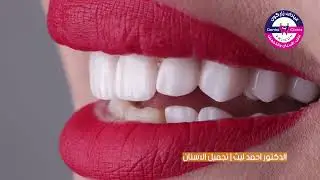 ابتسامة هوليود الدكتور احمد ليث