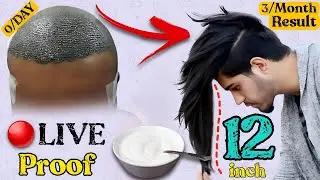 This winter, mix this one thing with curd and apply it, your hair will neither break nor fall nor...
