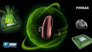 Exploring Phonak’s Revolutionary Infinio Hearing Aids with Those Who Made It Happen