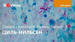 Циль - Нильсен: теория и практика