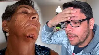 MINHA MÃE SOFREU UM ACIDENT*