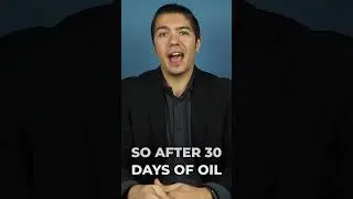 Oil Pulling for 35 Days: Did It Cure Gum Disease? Microscope Analysis🔬 