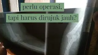 patah tulang siku, perlu operasi, tapi harus dirujuk jauh?