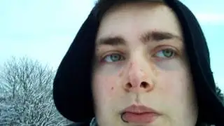 17 months on T [FTM]