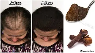 the Indian secret, 🌿 to grow hair at a rocket speed and treat baldness from the first week