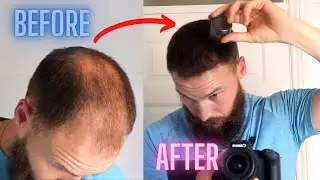 Hair Fibres For Balding Men - BIGGEST REASON I Think You Shouldn't Use Them